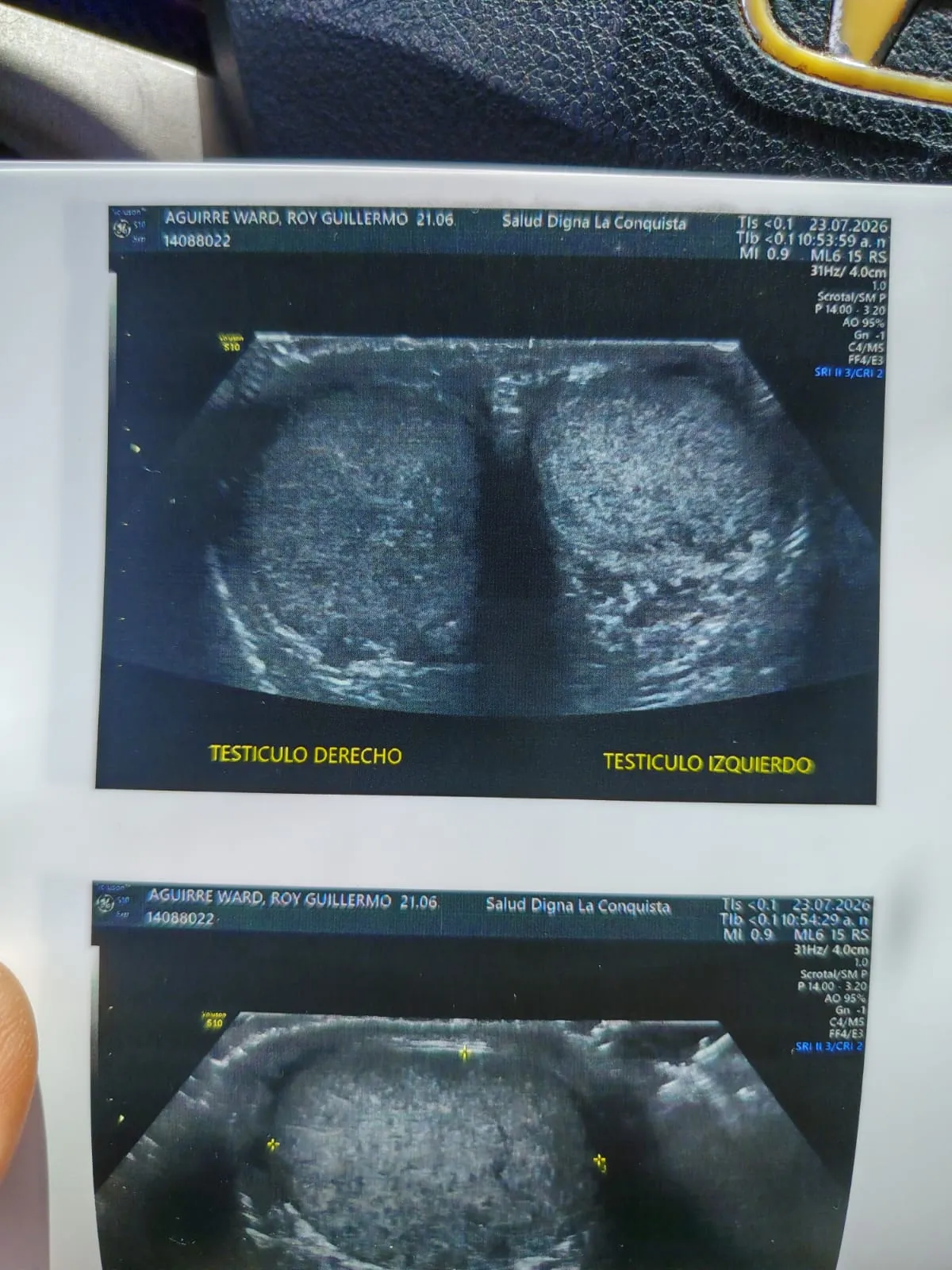 Ultrasonido relacionado con la historia médica